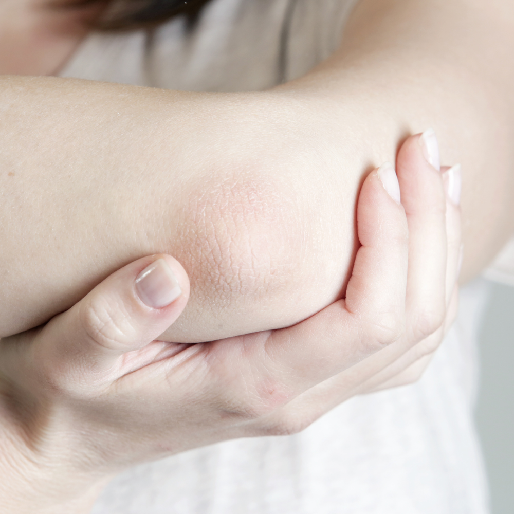Essential Oils for Itching